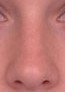 conk